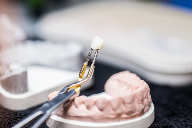 Hauseigenes Zahnlabor